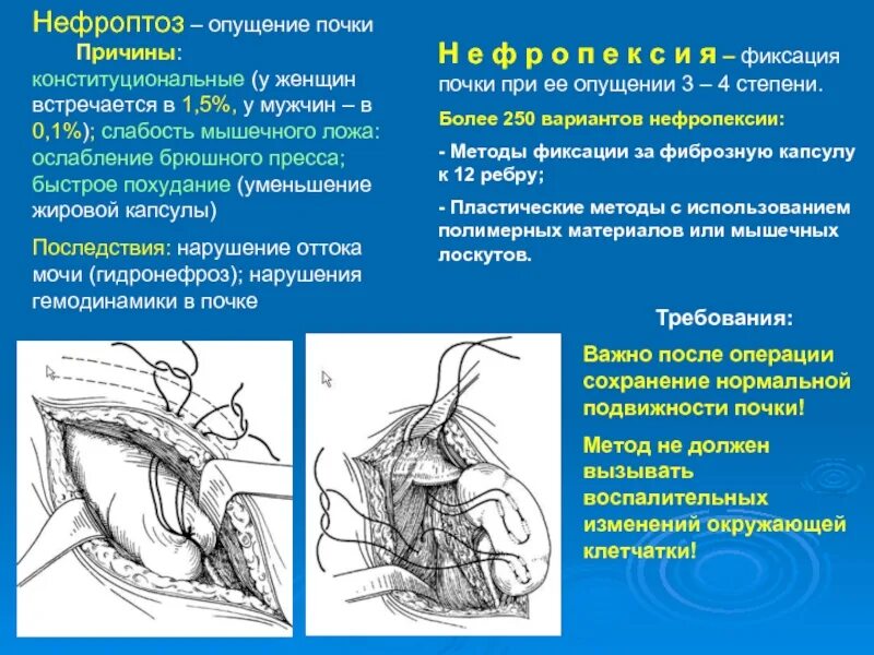 Опущение органов форум