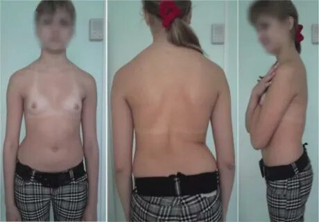 Ұйқы кезінде мастурбация