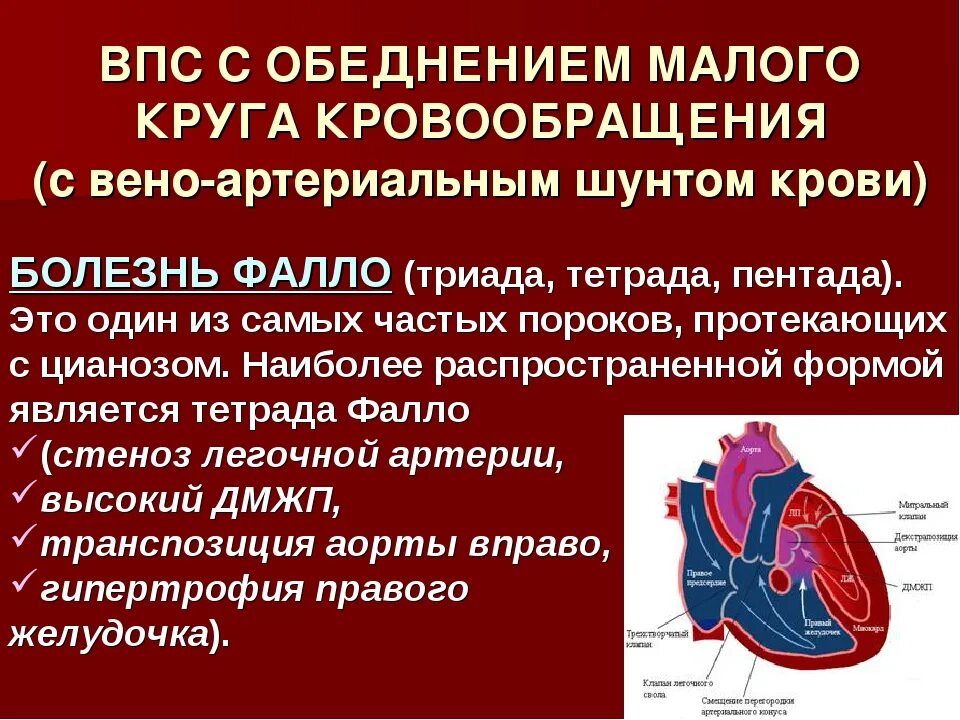 Гемодинамика пороков сердца. Врожденные пороки сердца у детей. Гемодинамика при врожденных пороках сердца. Синдромы при врожденных пороках сердца.