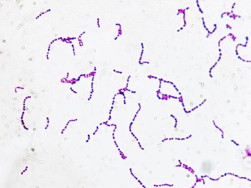 Sneathia spp