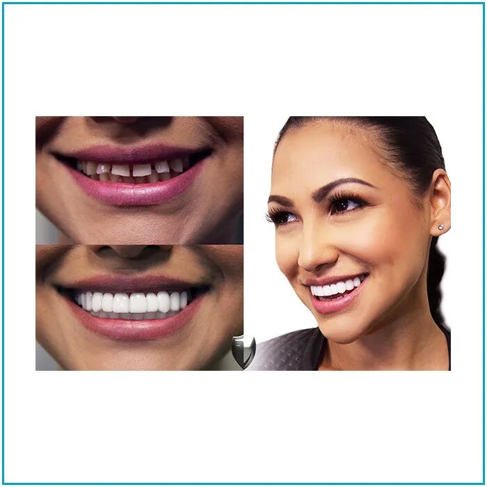 Красивые зубы. Красивые зубы. Красивая улыбка зубы. Красивая улыбка. Красивая улыбка.