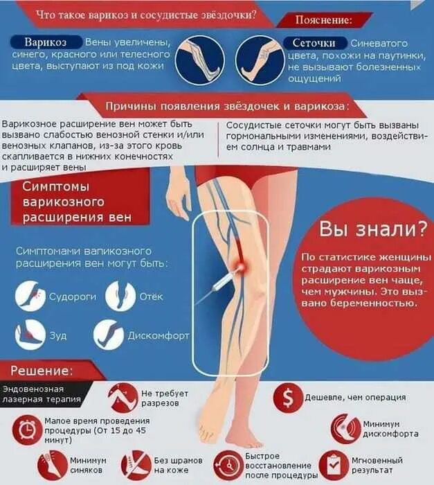 Чем отличается тромбоз. Профилактика варикоза на ногах. Варикозное расширение вен. Причины появления варикоза.