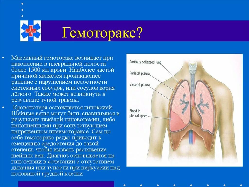 Гемоторакс причины. Травматический гемоторакс. Наличие крови в плевральной полости