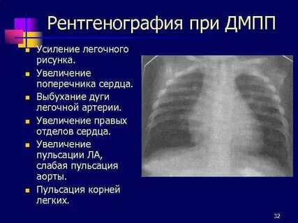 Диагноз усиление