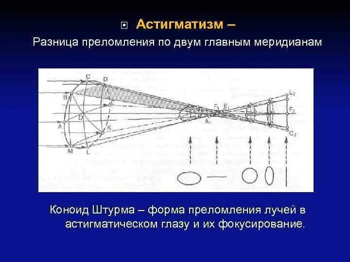 Калькулятор транспозиции астигматических