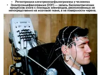 Ээг головного мозга москва