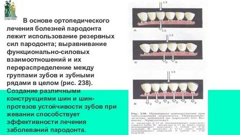 Методы ортопедического лечения