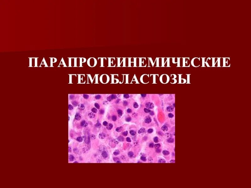 Парапротеинемические гемобластозы (миеломная болезнь). При парапротеинемических гемобластозах. Парапротеинемические гемобластозы основные формы. Парапротеинемические гемобластозы клинические рекомендации.