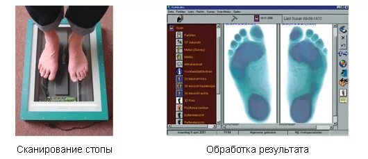 Компьютерная диагностика стоп. Компьютерное сканирование стопы расшифровка. компьютерное сканирование стоп плоскостопие. плантография. компьютерная плантография.