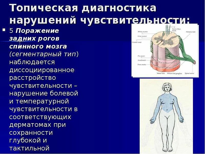 При поражении задних Рогов нарушается чувствительность. Типы расстройств чувствительности при поражении спинного мозга. Поражение задних Рогов спинного. Топическая диагностика нарушений чувствительности.