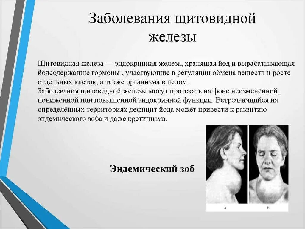 Симптомы нарушения гормонов. Заболевания щитовидной железы. Патология щитовидной железы. Заболевания связанные с щитовидной железой. Болезнищиьтовиднойжелезы.