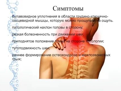 Воспаление грудино ключичного мышцы