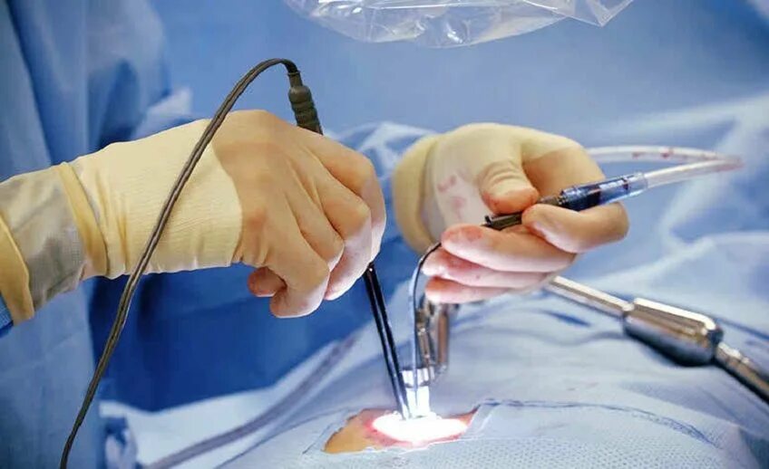 Endoscopic surgery. Endoscopic surgery. Лапароскопия миомы миомэктомия. Минимально инвазивная хирургия. Endoscopic surgery.