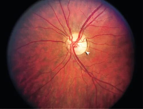 Dvd case 3d. примерка дисков на автомобиль по цвету. Cd (compact disc) — оптический носитель. примерка дисков на авто приложение. визуальный диск.