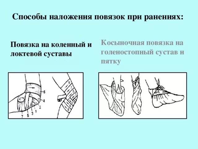 Какая повязка накладывается при повреждении голеностопного сустава. Косыночные повязки на коленный сустав. Наложение косыночной повязки на коленный сустав. Косыночная повязка на голеностопный сустав. Способы наложения повязок при ранениях.