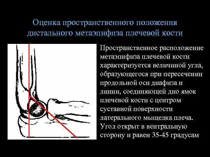 Оценка пространственного положения