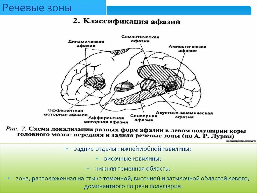 Нарушение речи виды афазий