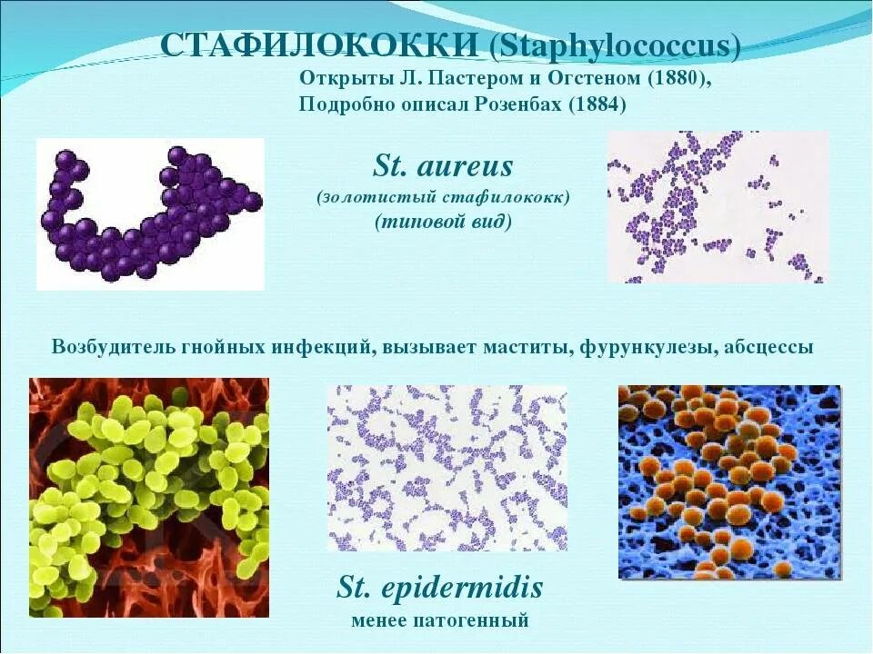 Стафилококки коагулазоположительные s. aureus. Стафилококк ауреус микробиология. Стафилококк ауреус золотистый. Бактерия стафилококк Тип питания. Staphylococcus aureus степени