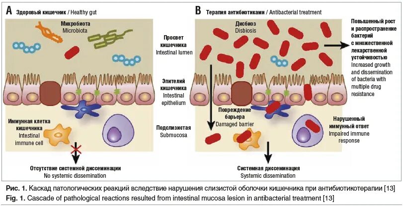 После приема антибиотиков понос. Антибиотиков ассоциативный колит. Антибиотик ассоциированный колит. Антибиотикоассоциированного колита. Антибиотико ассоциированный синдром.