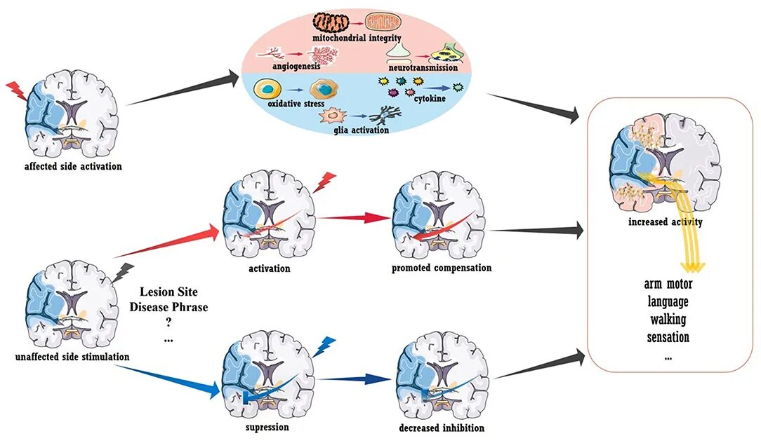 After brain. TDCS своими руками. Механизм действия TDCS. Устройство TDCS В домашних условиях. Нейростимуляция TDCS.