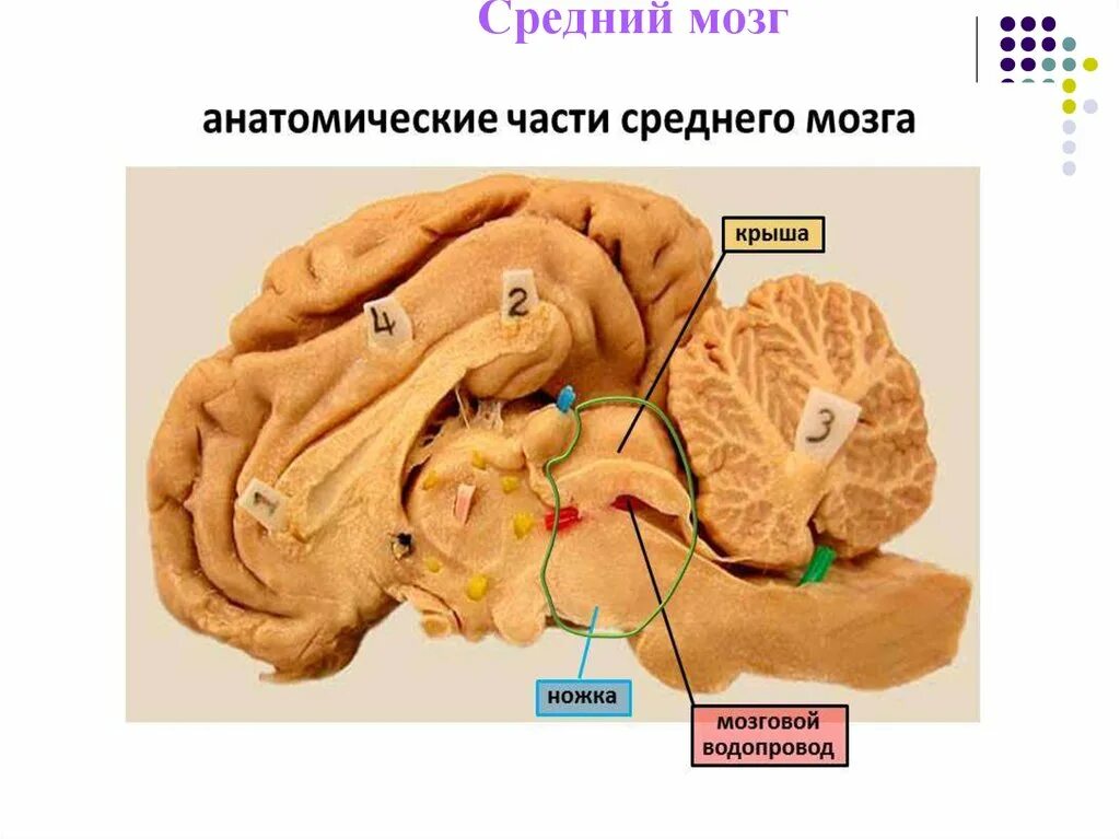Мозги на ножках