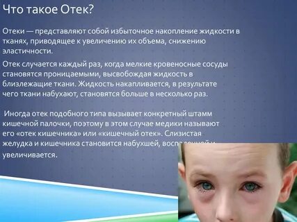 Почему человек сильно отекает