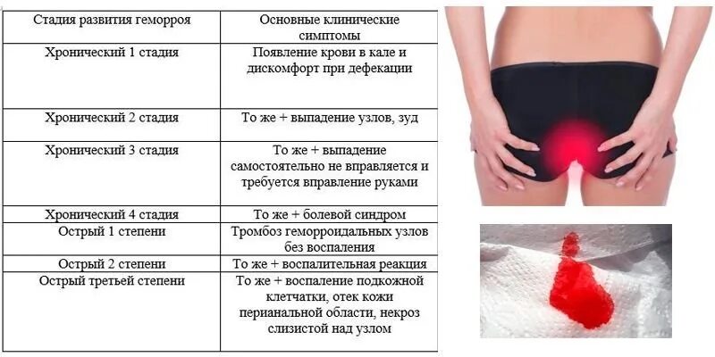 Неприятные ощущения проходят после