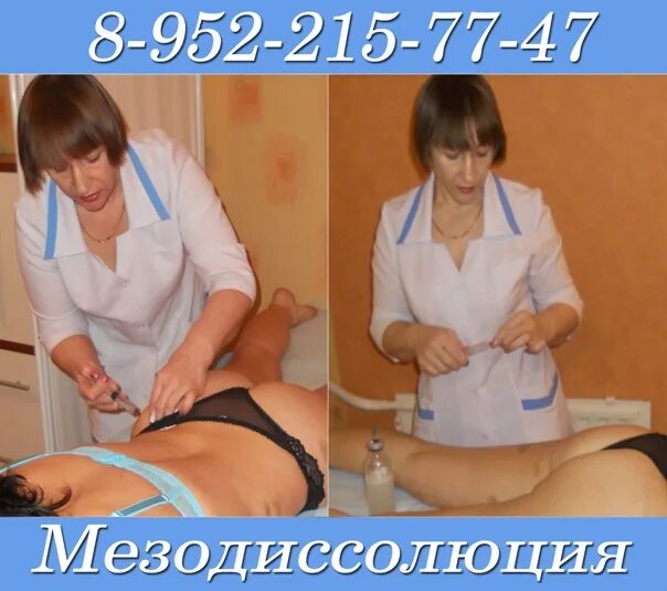 Мезодиссолюция. Гипоосмолярный раствор для липолиза. мезодиссолюция до и после. липолитики, мезодиссолюция.