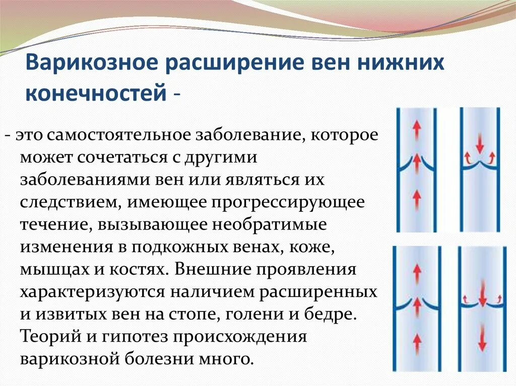 Мкб варикозная болезнь вен нижних. Варикозное расширение вен нижних конечностей. Варикозное расширение вен (ВРВ) нижних конечностей. Варикозное расширение вен нижних конечностей презентация. Классификация варикозно расширенных вен нижних конечностей.