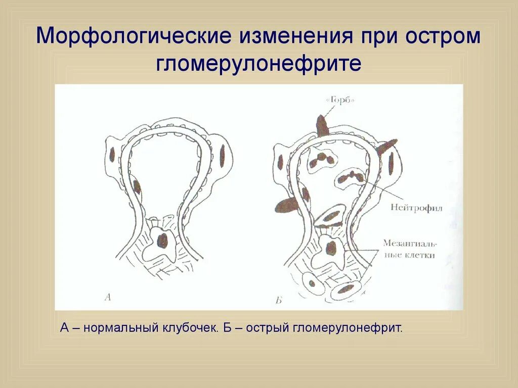 Морфологическое изменение почек