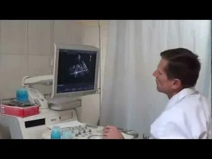 Узи головы и шеи ижевск