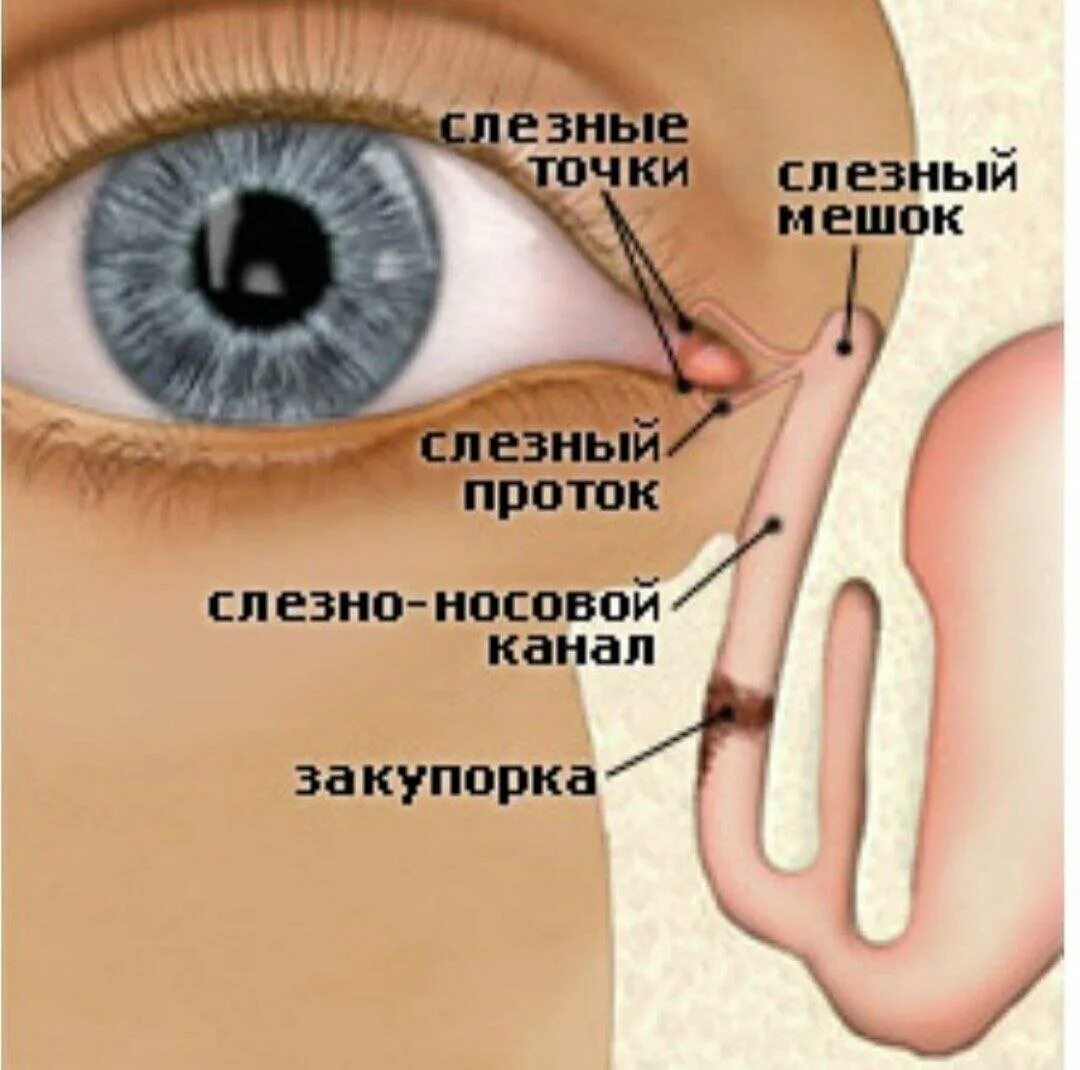 Слезные каналы где. Воспаление слезного канала дакриоцистит. Дакриоцистит врожденный глаз. Анатомия глаза слезный мешок. Слезная железа и слезный мешок.