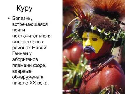 Болезнь куру