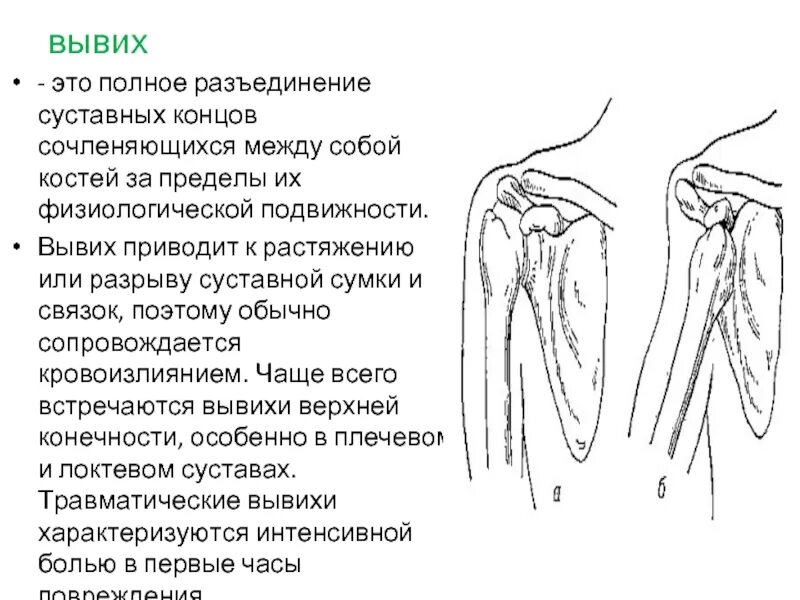 Угловая деформация. Повреждение костей и суставов. Полное расхождение суставных концов костей. Открытые и закрытые вывихи. Костно суставные деформации.