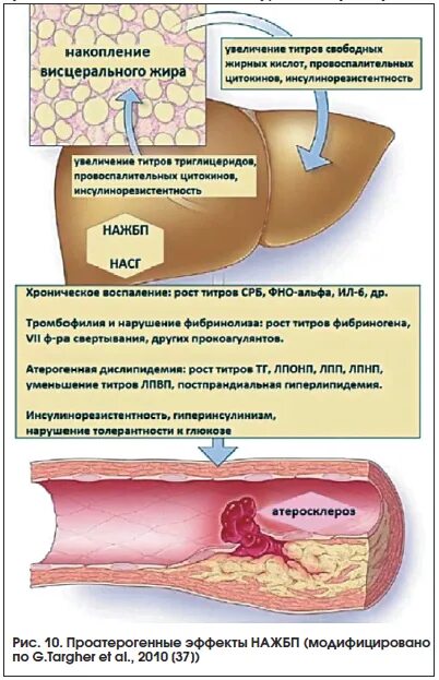 Причины жировой печени. Неалкогольная жировая болезнь печени. Неалкогольная жировая болезнь печени этиология. Неалкогольный жировой гепатоз. Неалкогольная жировая болезнь печени клиническая картина.