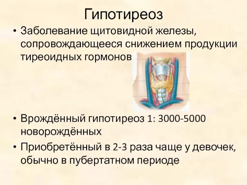 Щитовидная восстановилась. Заболевание щитовидной железы гипотиреоз. Гипотиреоз – заболевание, сопровождающееся сниженной продукции:. Гипотиреоз у новорожденных.