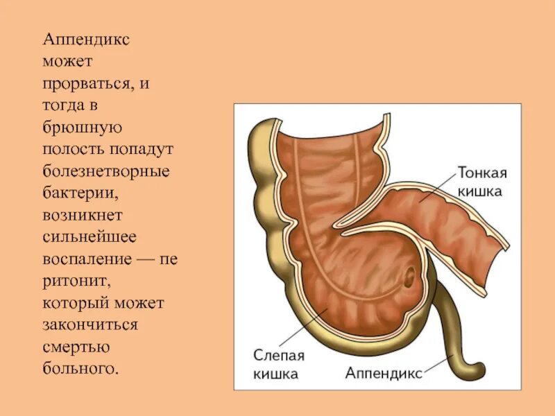 Развитие аппендикса. Червеобразный отросток слепой кишки. Слепая кишка с аппендиксом. Аппендикс кишка строение.