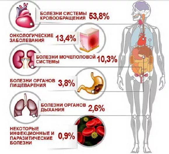 Причины болезни кровообращения. Причины возникновения раковых заболеваний. Причины возникновения онкологических заболеваний. Причины заболеваний системы кровообращения. Причины заболевания онкологией.