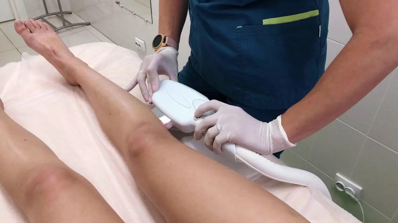 Лазерная эпиляция ноги skinlift. Аппарат 1s Pro IPLASER. IPL Laser 1s Pro. Фотоэпилятор 1s Pro. Лазерная эпиляция.