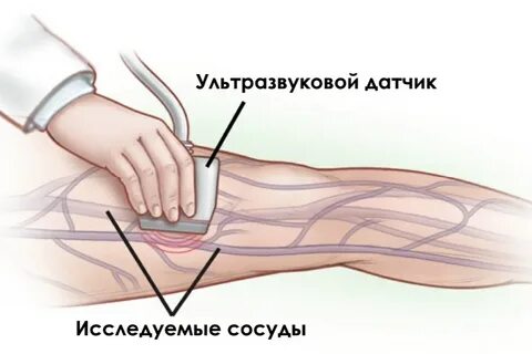 Триплексное сканирование вен нижних конечностей