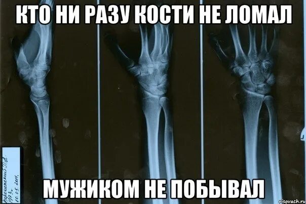 Не ломай ничего. Не ломай ничего