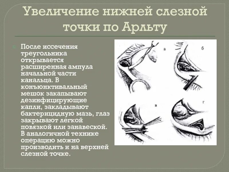 Активация слезных точек. Показатели давления у гипотоников. Величина систолического артериального давления норма. Нормальные показатели иад. Низкое нижнее давление причины.