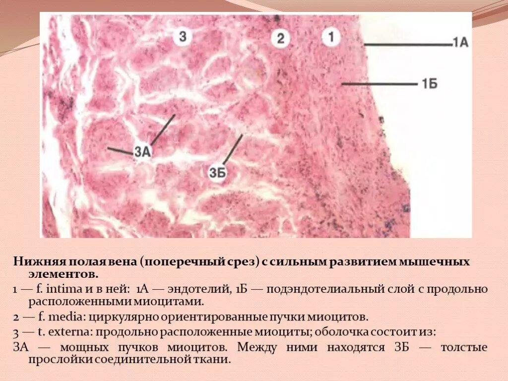 Вена безмышечного типа гистология. Верхняя полая Вена гистология препарат. Вена мышечного типа препарат гистология. Нижняя полая Вена гистология препарат.