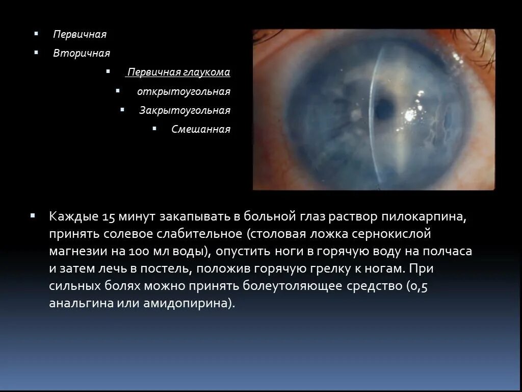 Вторичная факолитическая глаукома. Факотопическая глаукома. Вторичная открытоугольная глаукома. Первичная открытоугольная глаукома.