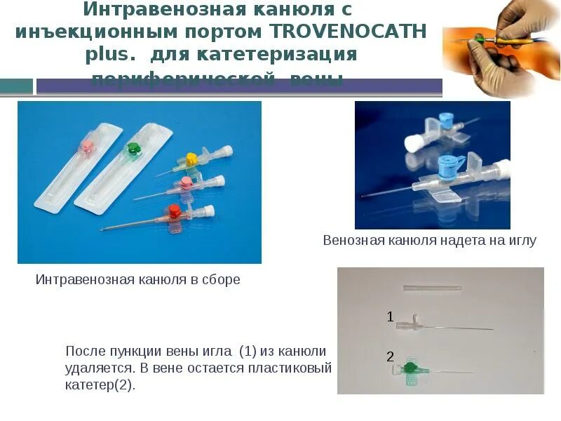 Почему после катетера. Постановка катетера венозного алгоритм. Внутривенный катетер алгоритм. Периферический катетер алгоритм. Чрескожная катетеризация периферических вен.