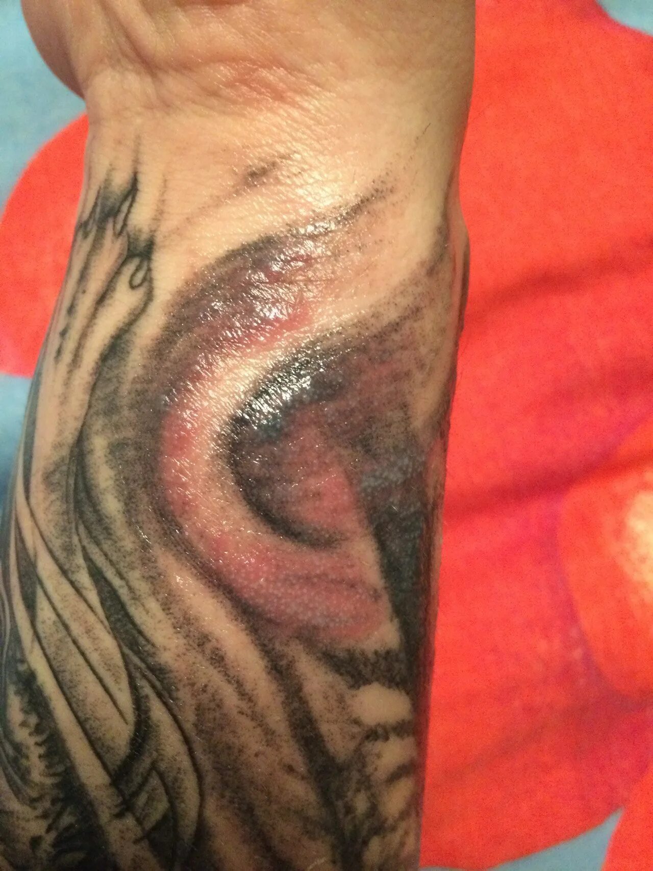 покраснение татуировки