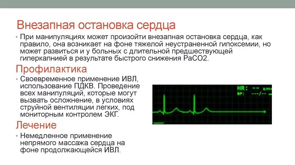 Остановился на 9 минуте. Профилактика остановки сердца. Кратковременная остановка сердца. Внезапная остановка сердца.