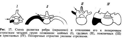 Аномалии строения позвонков. Поперечный диаметр тела позвонка. Вариант развития поперечных отростков позвонков. Крючковидный отросток позвонка. Реберный отросток шейного позвонка.