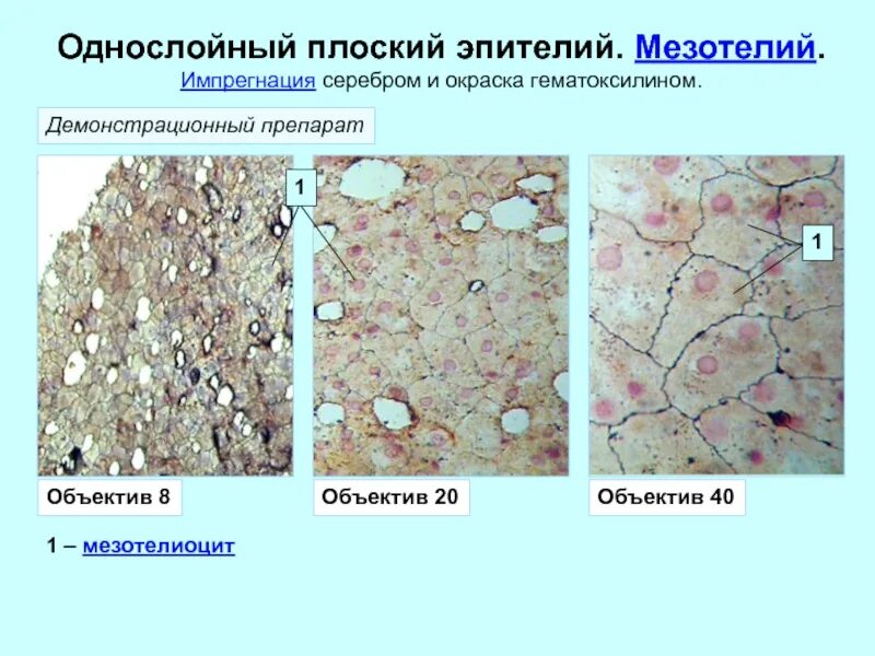 Однослойный плоский мезотелий. Мезотелий импрегнация серебром. Мезотелий сальника гистология. Однослойный плоский эпителий мезотелий. Однослойный однорядный плоский эпителий мезотелий сальника.