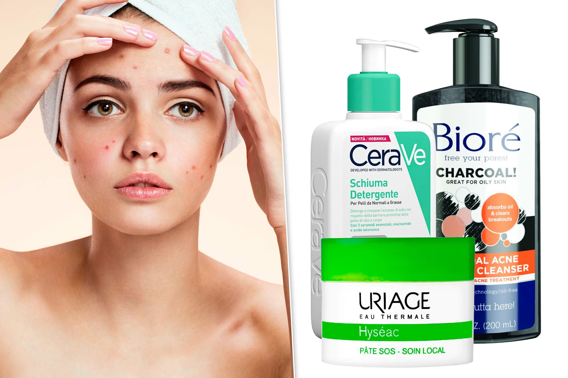 Средства для кожи с акне. Гомеопатические средства от акне. Cetaphil pro spf 30. Средство от прыщей на лице. Средства для кожи с акне.